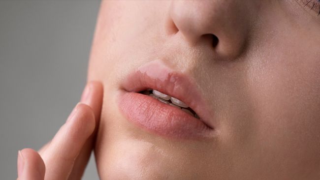 Kulit Kering di Sekitar Bibir? Ini Dia 4 Cara untuk&nbsp;Mengatasinya