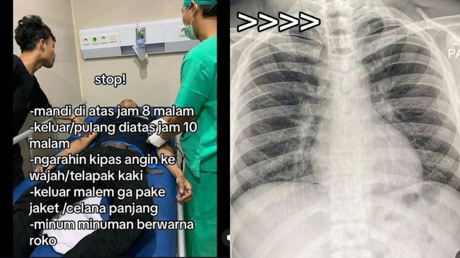 Menurut Dokter Ini yang Jadi Pemicu Paru-paru Basah, Bukan Mandi Malam-Pakai Kipas&nbsp;Angin!